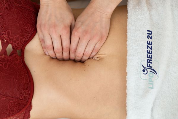 diastasis recti treatment Banbury