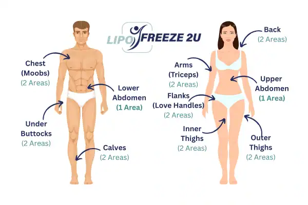 Areas you can have fat freezing treatment Banbury