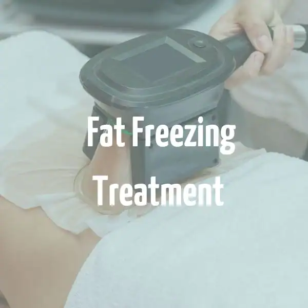 fat freezing treatment Banbury