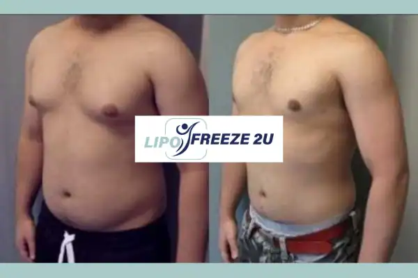 How Long Does It Take to See Results Banbury?