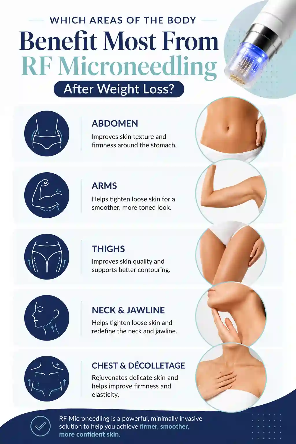 Which Areas of the Body Benefit Most From RF Microneedling After Weight Loss Banbury